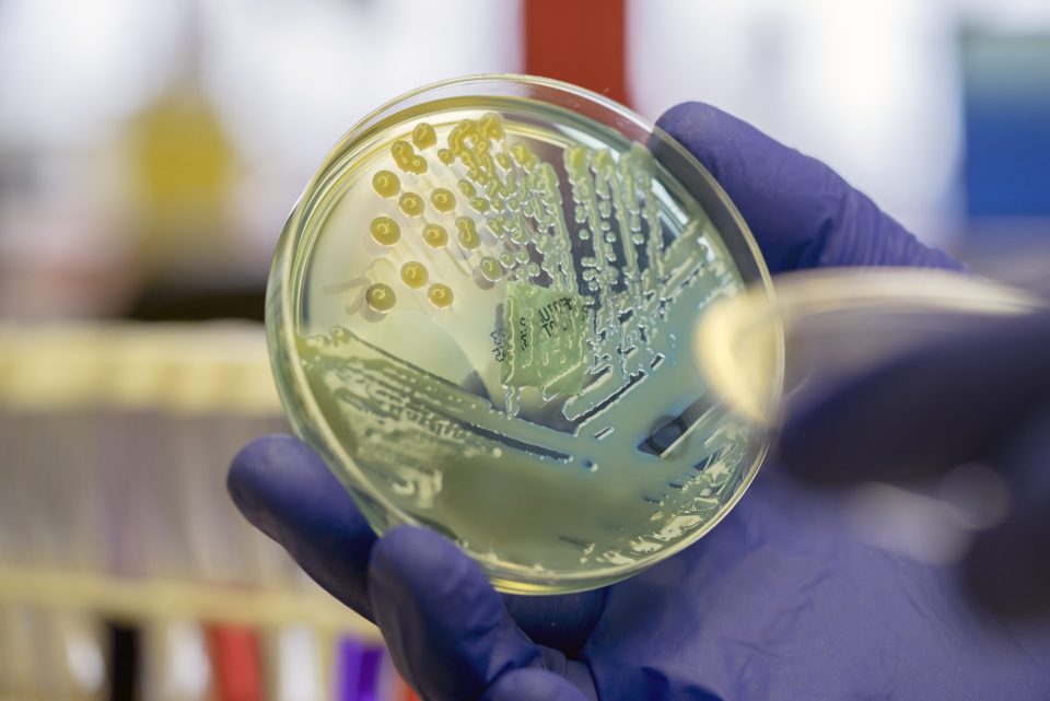 Microbiologist examining a multi-drug resistant coliform (Klebsiella pneumoniae) bacteria on CLED agar plate.
